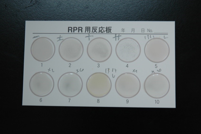 梅毒検査法（カード法）