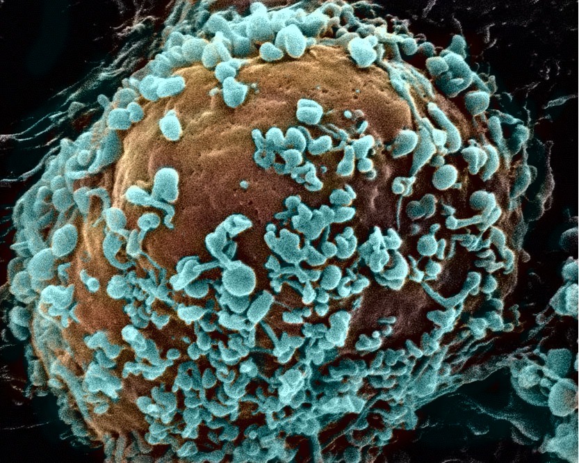 細胞表面から出芽する新型コロナウイルス粒子の電子顕微鏡写真 東京都健康安全研究センターの写真からの引用