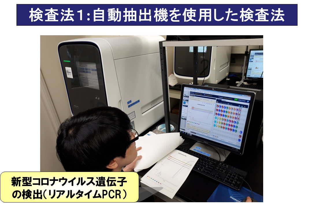 リアルタイムPCR装置による検査