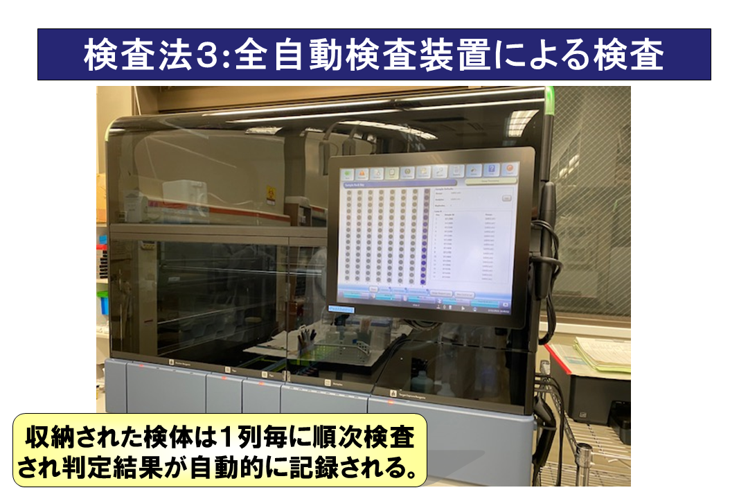 自動検査装置の外観