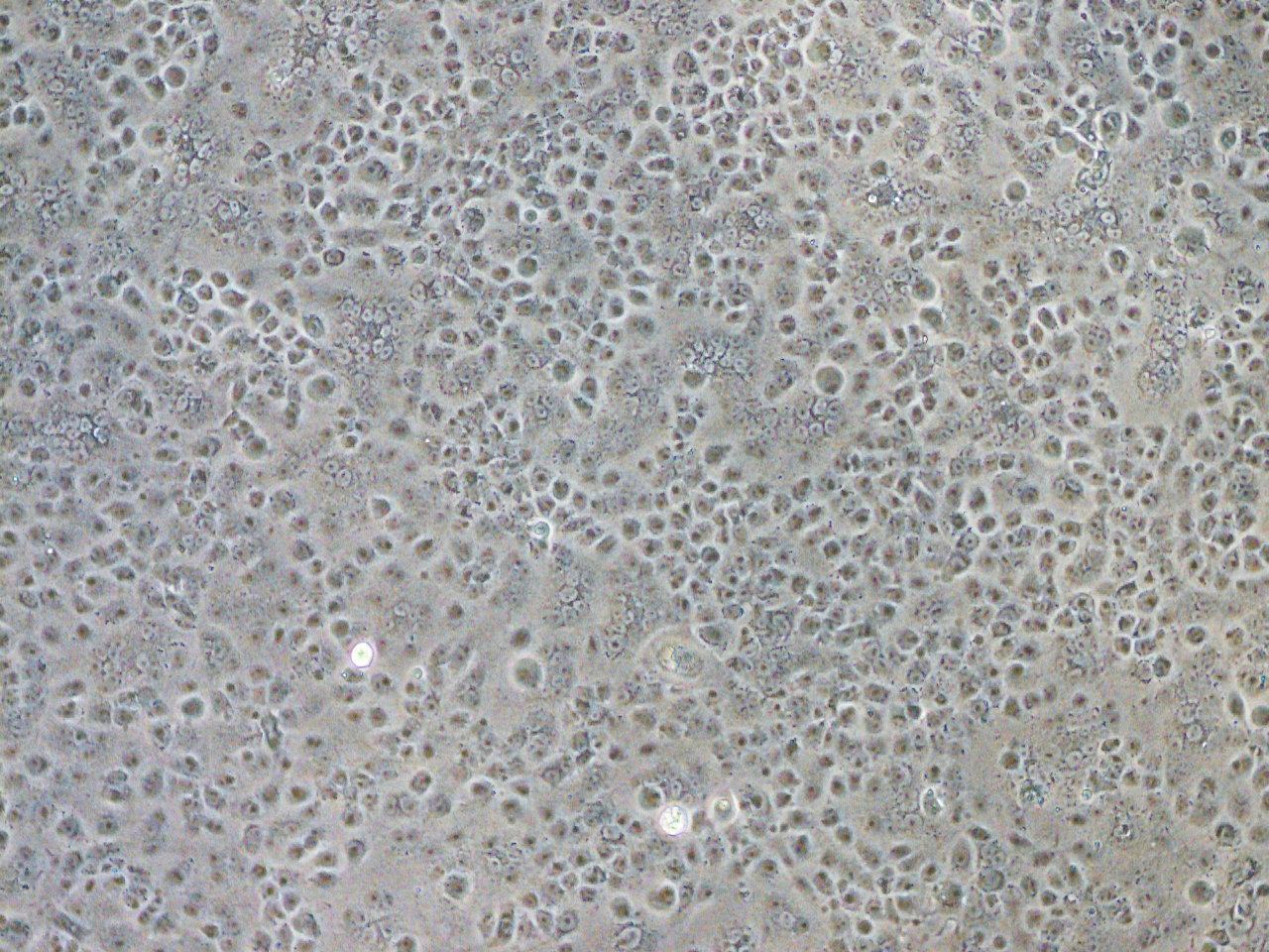 合胞体の現れたVero細胞